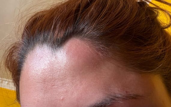 Customer photo review of IGORA ROYAL - Coloración Permanente - 60ml