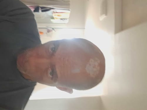 Customer photo review of EXTRA STRENGTH REPLACEMENT