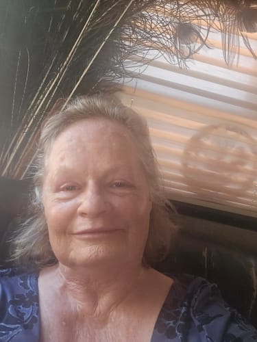 Customer photo review of Neptune Grass Fed Tallow & Honey Balm (Whipped) 4oz