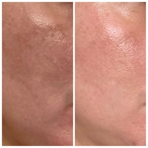 Customer skin photo review