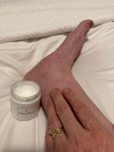Customer photo review of Mama Bear Nerve Relief Lotion