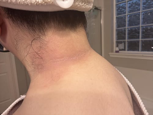 Customer before and after photo review