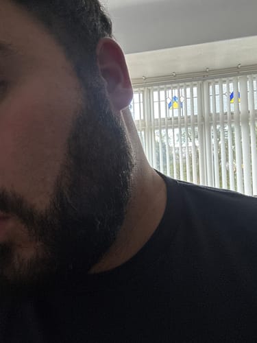 Customer photo review of Seb Natural Calming Serum