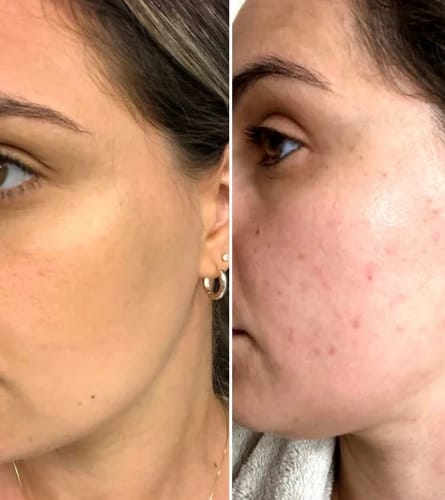 Customer photo review of Labbok 24h Οil Free Moisturizing Cream, 50ml