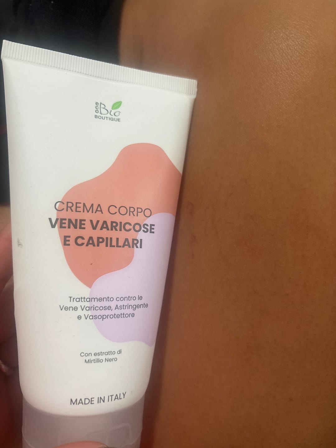 Customer photo review of Crema Vene Varicose e Capillari