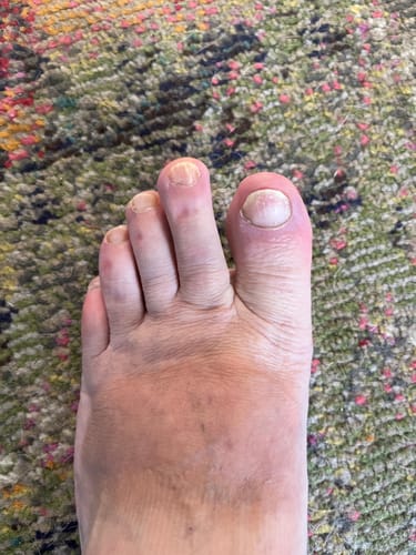 Customer photo review of Fungal Freedom