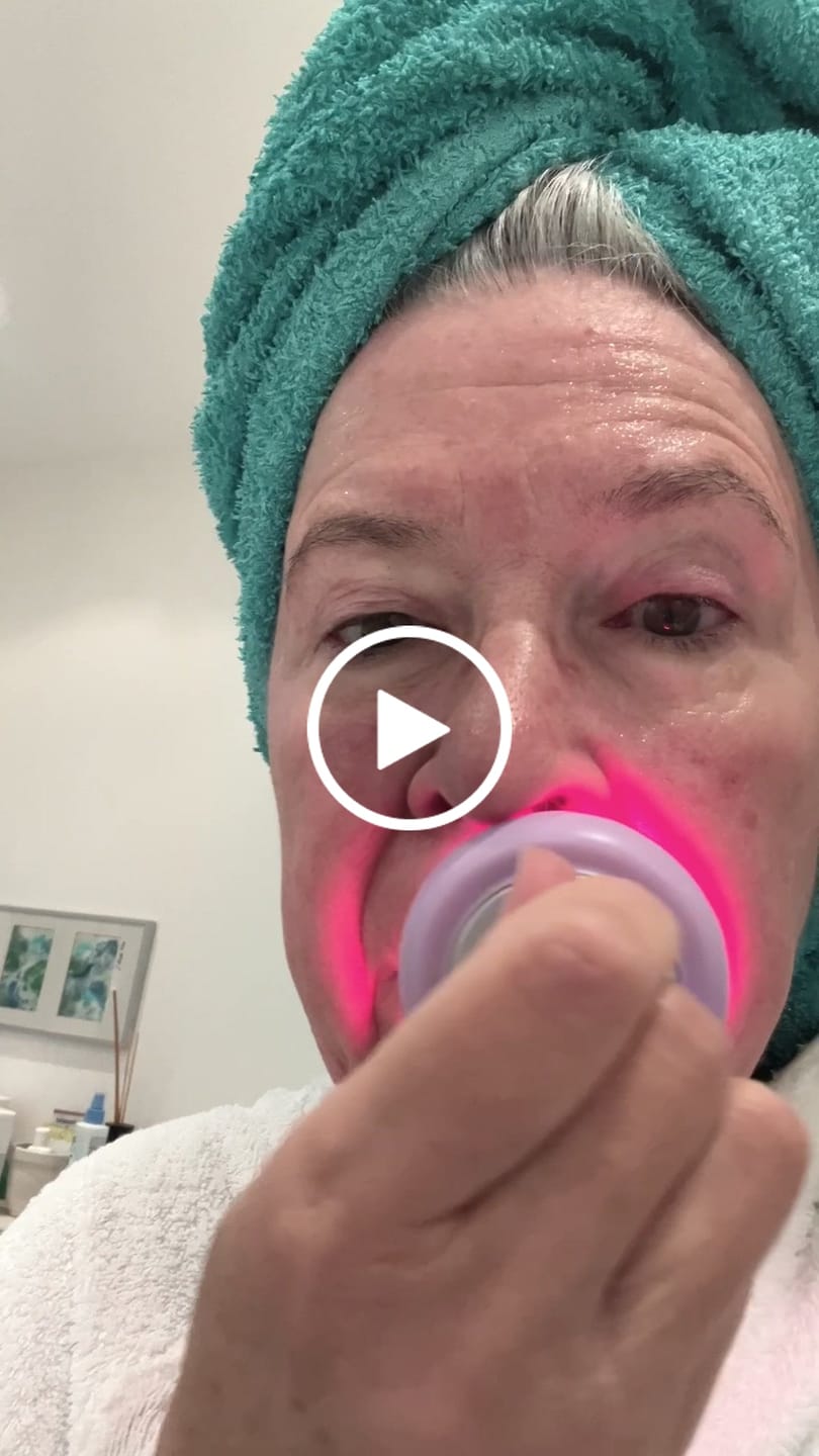 Customer video review of Koanna® Deepr™ ØØ5 – Rotlicht-Gerät für straffe Haut