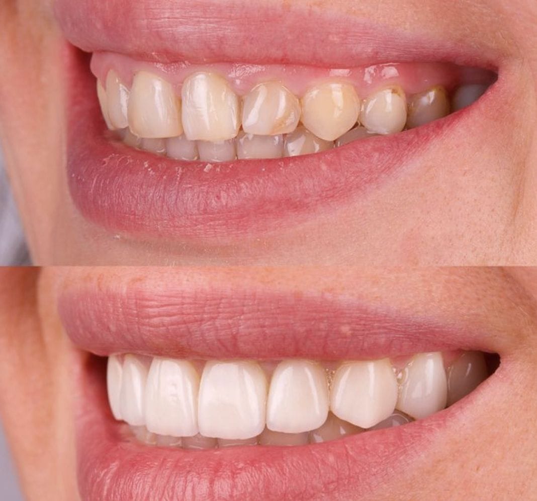 Customer photo review of Naïthera™ - pour la santé bucco-dentaire