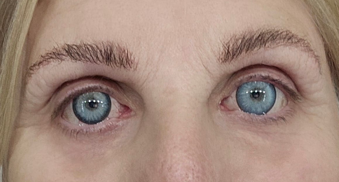 Customer photo review of Aine Swan Lake Blue Prescription Coloured Contact Lenses