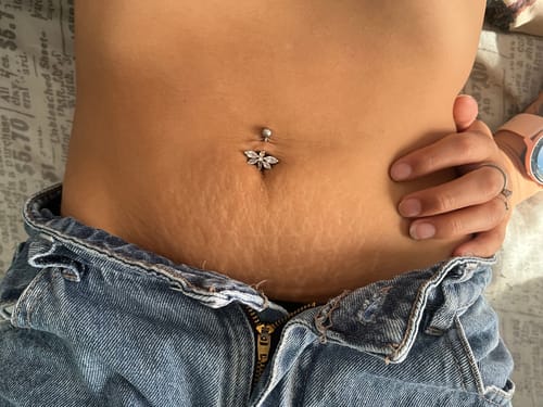 Customer photo review of Crema para Estrías EMILY 200ml🧴🦵 con Jojoba, B5 y Ácido Hialurónico