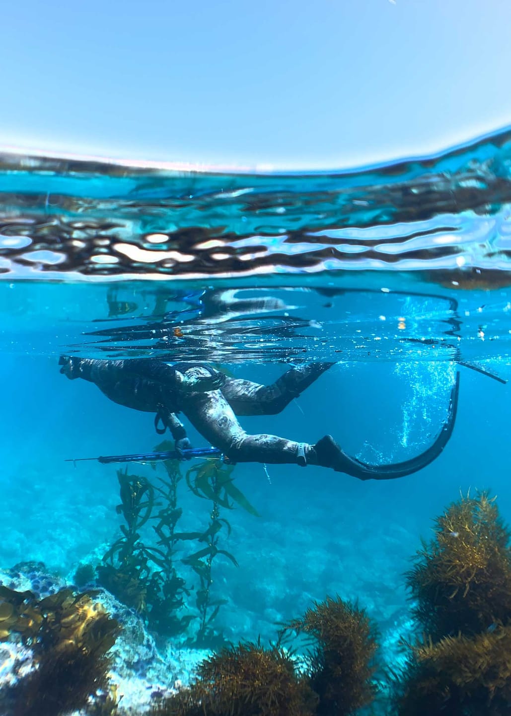 Customer photo review of Sharkbanz 2 – Wearable Shark Deterrent