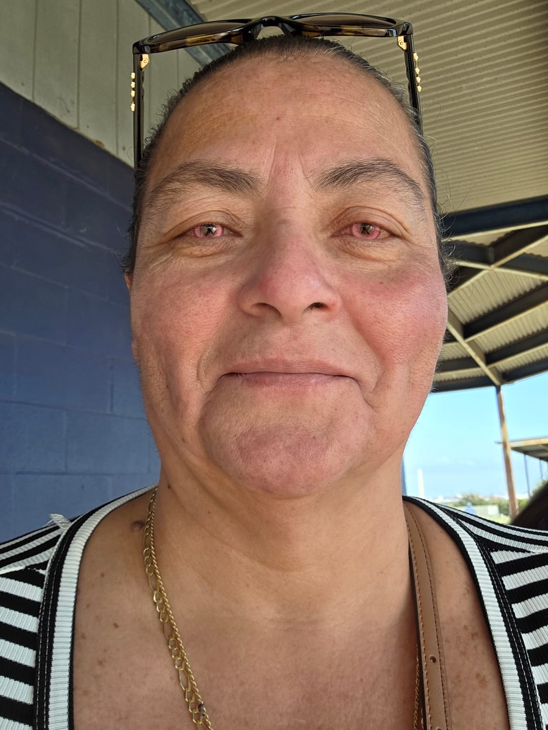 Customer photo review of Cosplay Fairy Rose Pink Colored Contact Lenses