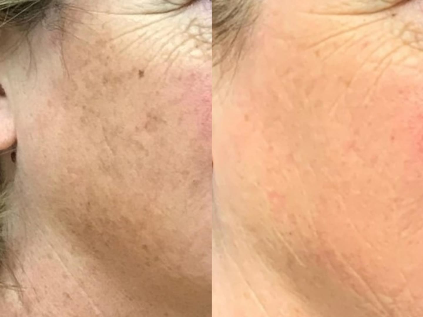 Customer photo review of Labbok Skin Lightening Cream, 30ml