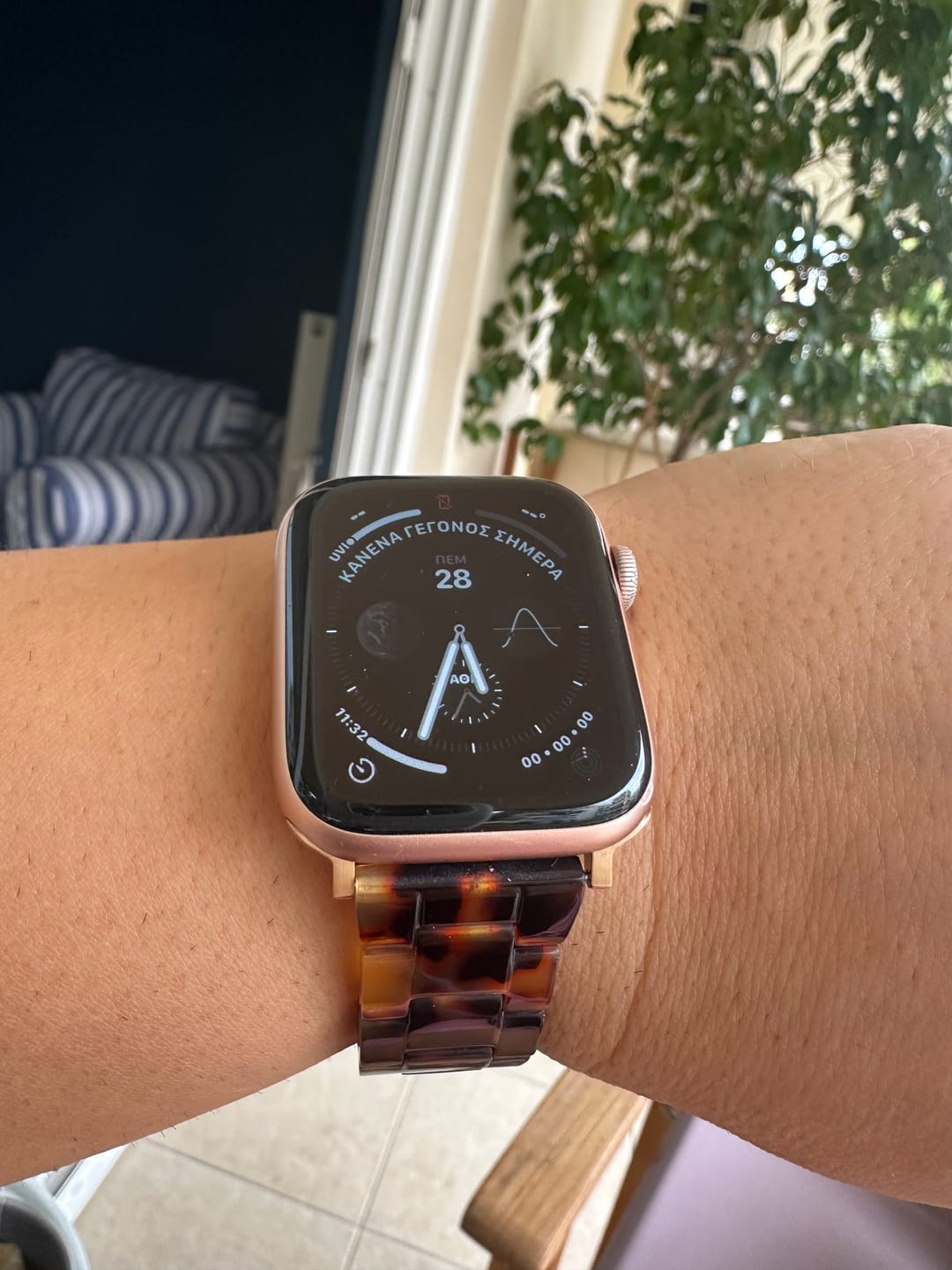 Customer photo review of Perla Ceramic Strap