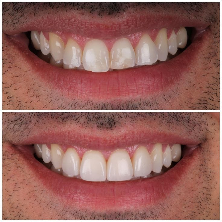 Customer photo review of Naïthera™ - pour la santé bucco-dentaire