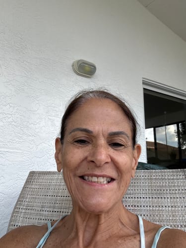 Customer photo review of Hyaluronic Serum Sealer