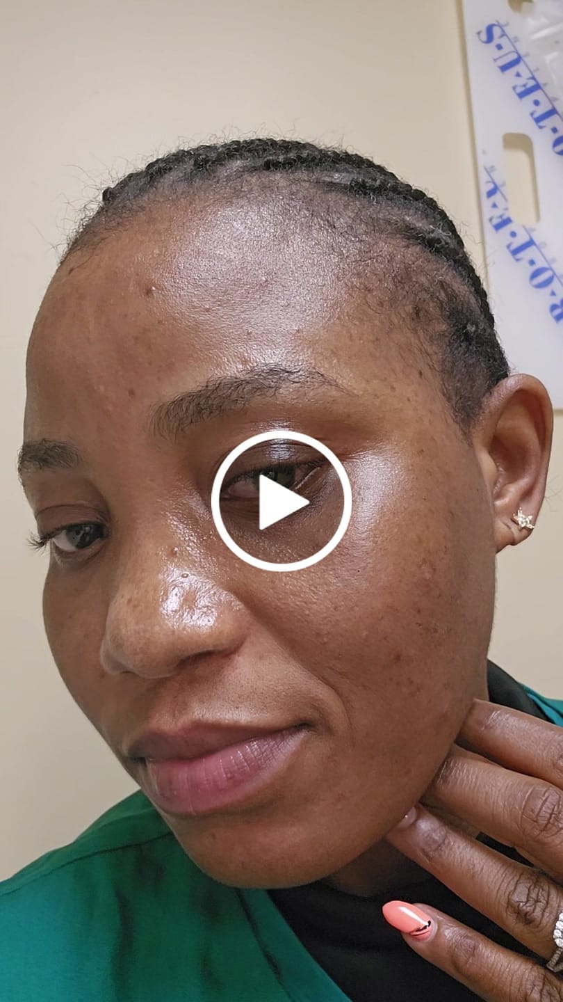 Customer video review of Intense Discoloration Treatment (Rapid Action)