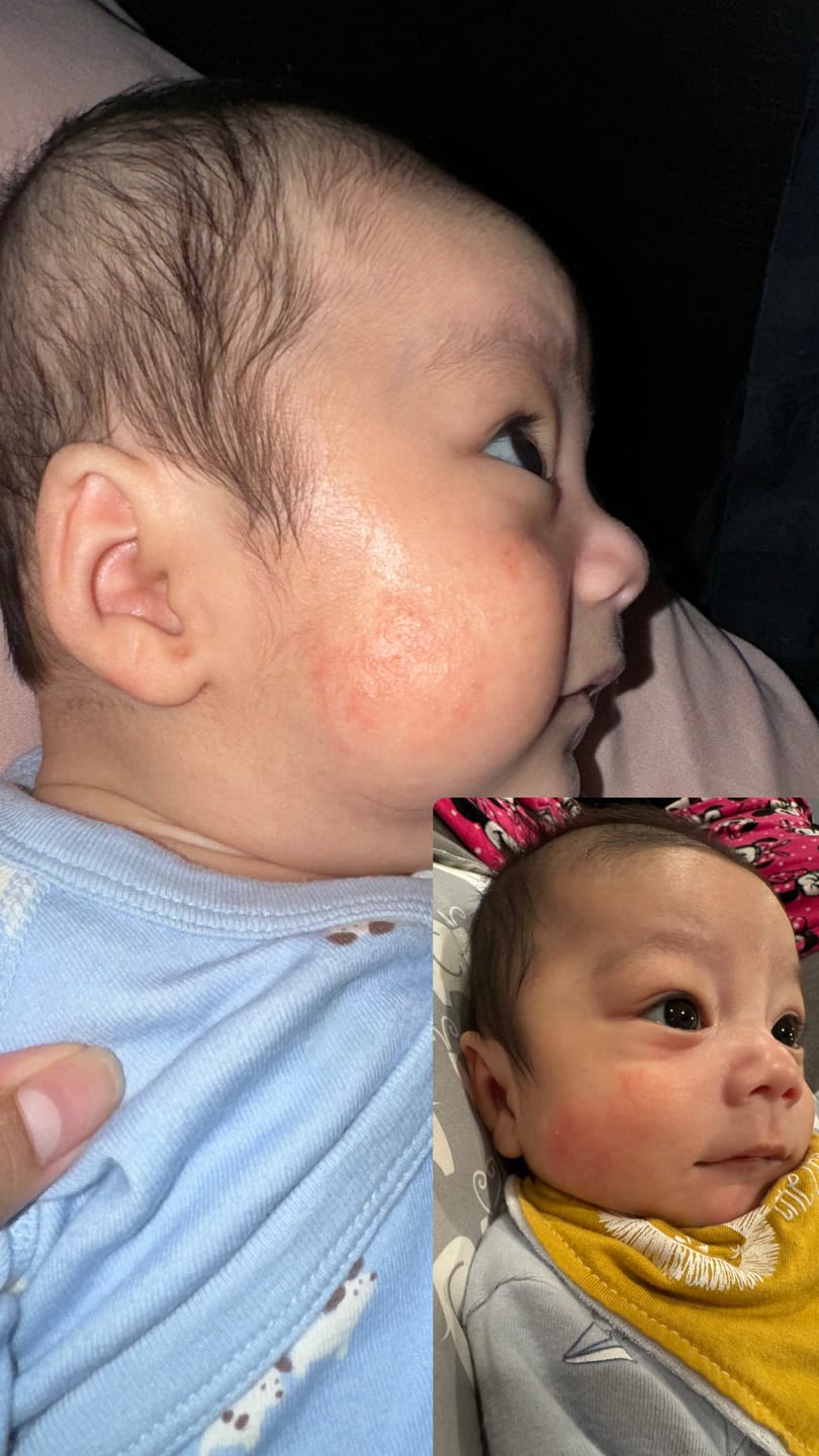 Customer photo review of Organic Emu Tallow Balm, Unscented, 60 ml