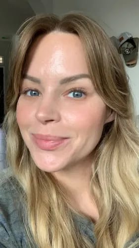 Customer photo review of Niacinamide Jelly Crème