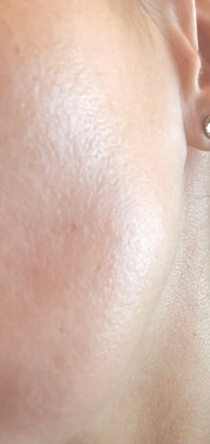 Customer photo review of Hyaluron Serum