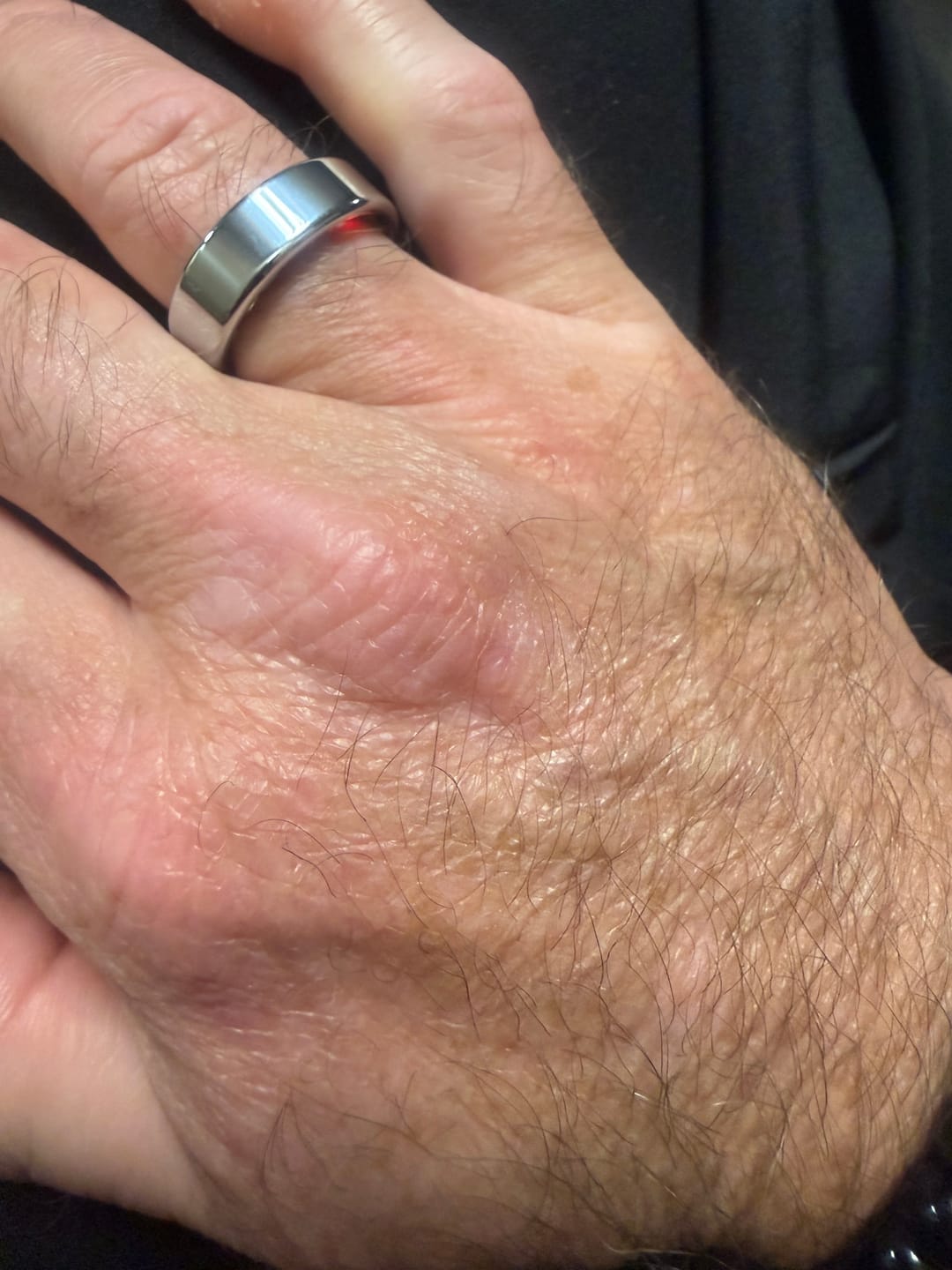 Customer photo review of Bearscome R03 Blood Sugar Blood Pressure Blood oxygen HRV Sleep Monitoring Waterproof Smart Ring