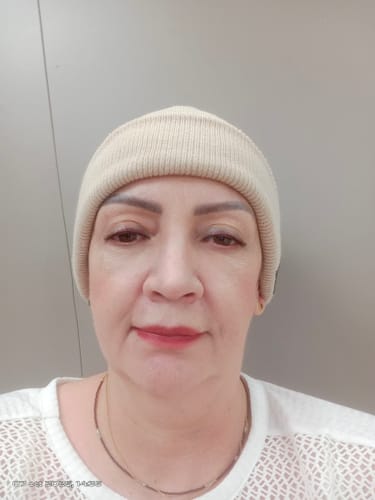 Customer photo review of BASE DE MAQUILLAJE LÍQUIDA 1ST SCENE
