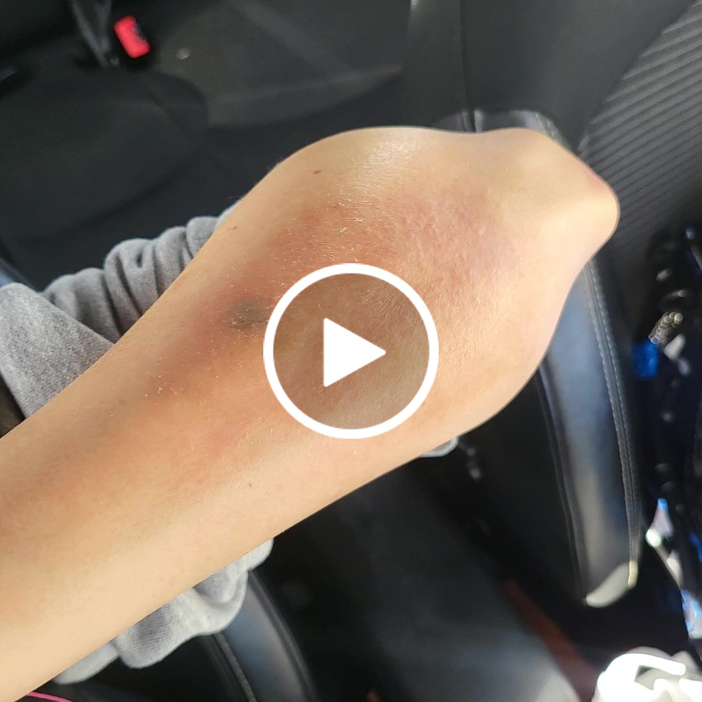 Customer video review of Vibrant Combo (4 RCV + 1 NSE)