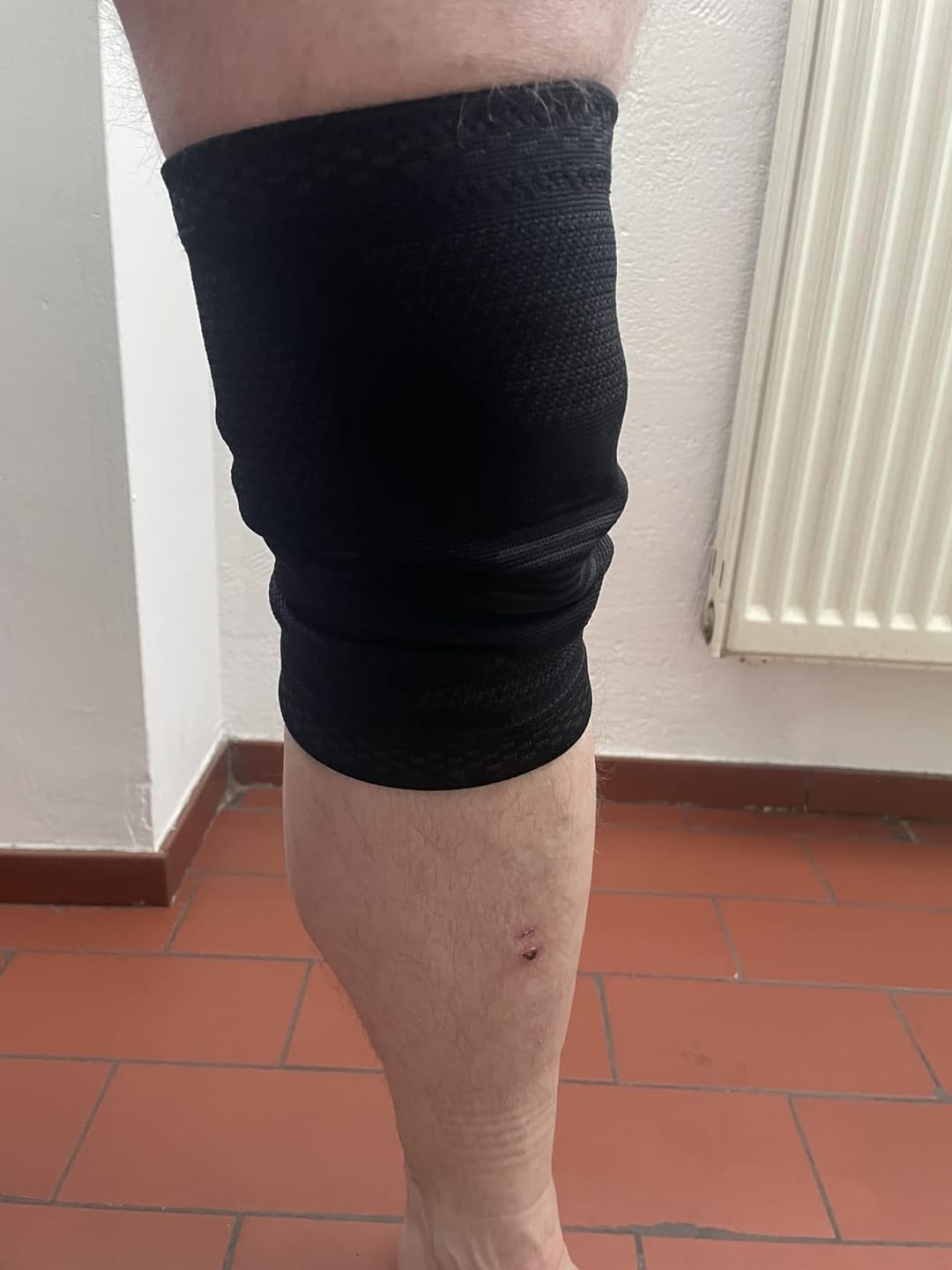 Customer photo review of Orthopädische Kniebandage O´FAB Pro®+