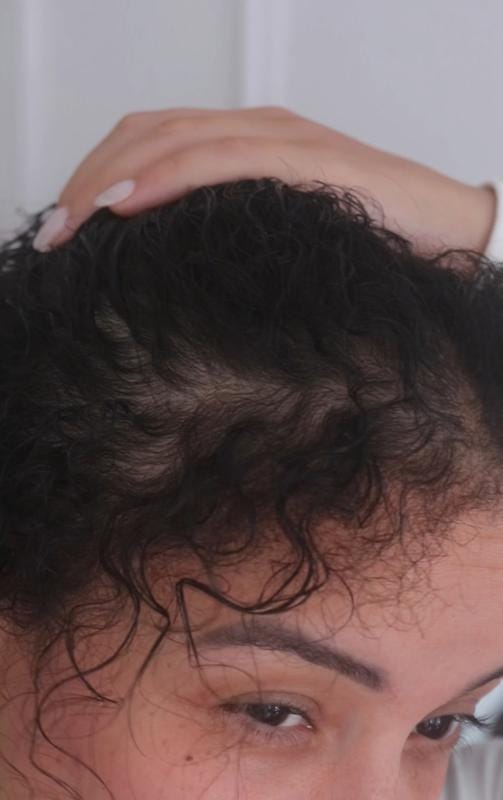 Customer photo review of Hair Growth Gummies