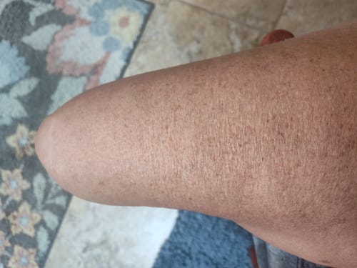 Customer photo review of Besque™ Magic Body Oil - 100ml