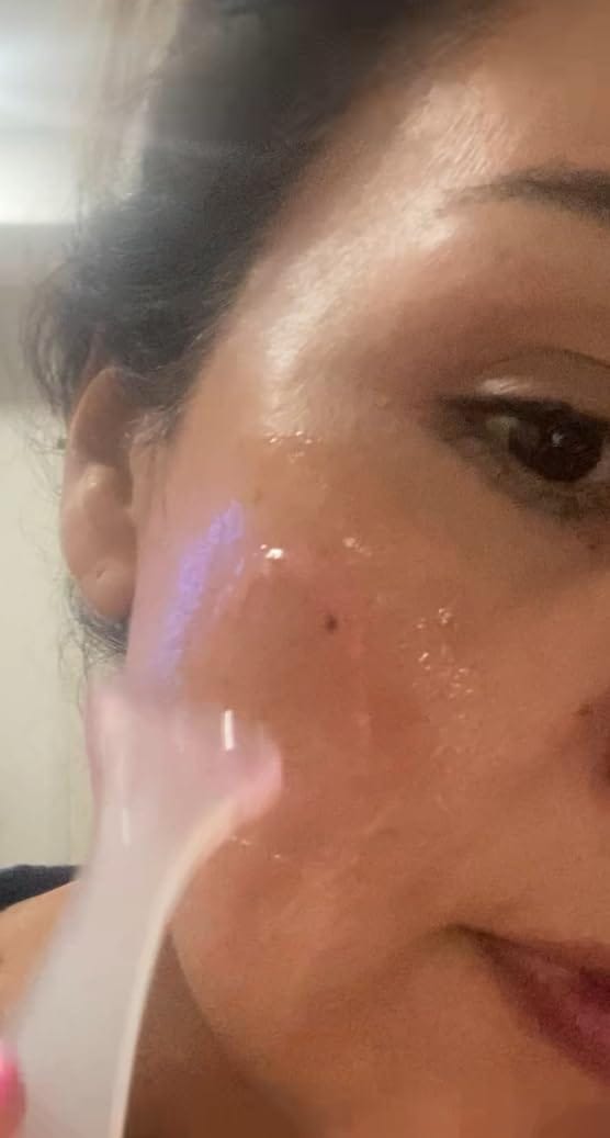 Customer photo review of Niacinamide Jelly Crème
