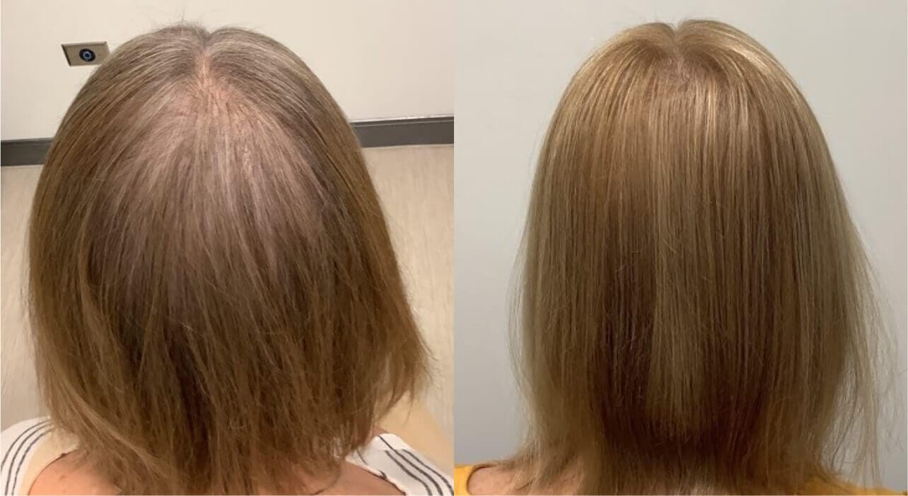 Customer photo review of Hair Growth Gummies