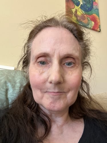 Customer photo review of Grass Fed Tallow & Honey Balm