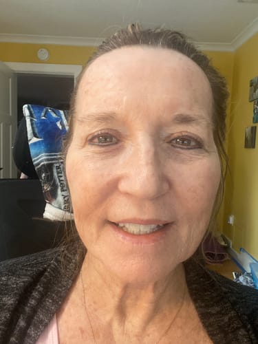Customer photo review of Glov Micro Infusion System