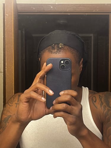 Customer photo review of Rennora Hair Growth Serum