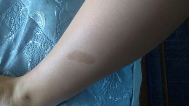 Customer photo review of Frankincense Balm