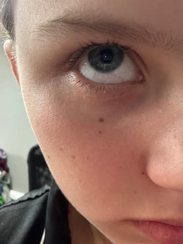 Customer photo review of LURIA Siero Per Ciglia