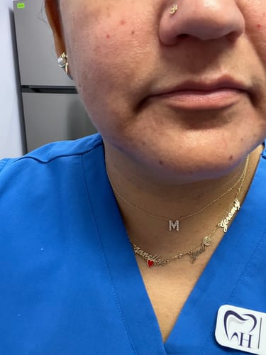 Customer photo review of INIA FLARE Microcurrent Facial Device