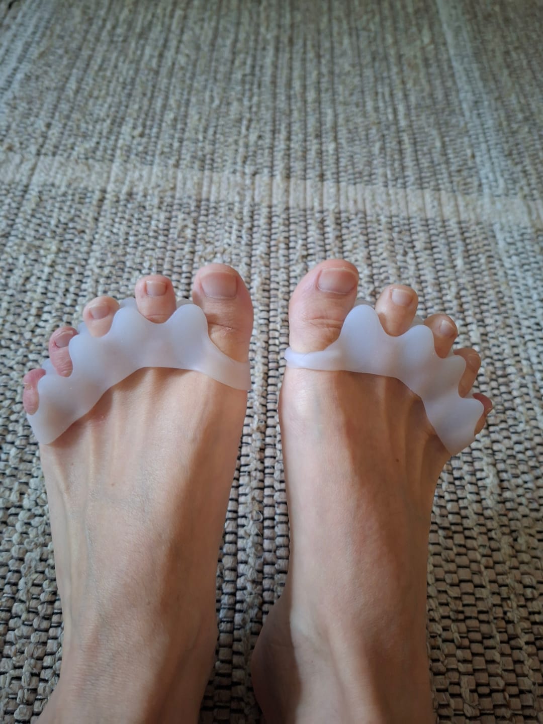 Customer photo review of Vaistoa Varpaiden Erottajat