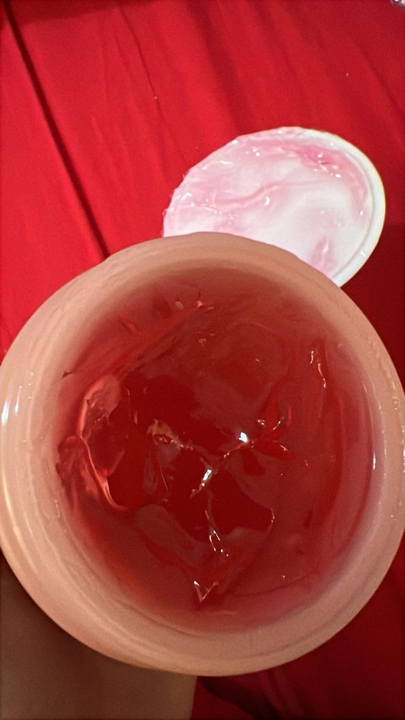 Customer photo review of Niacinamide Jelly Crème