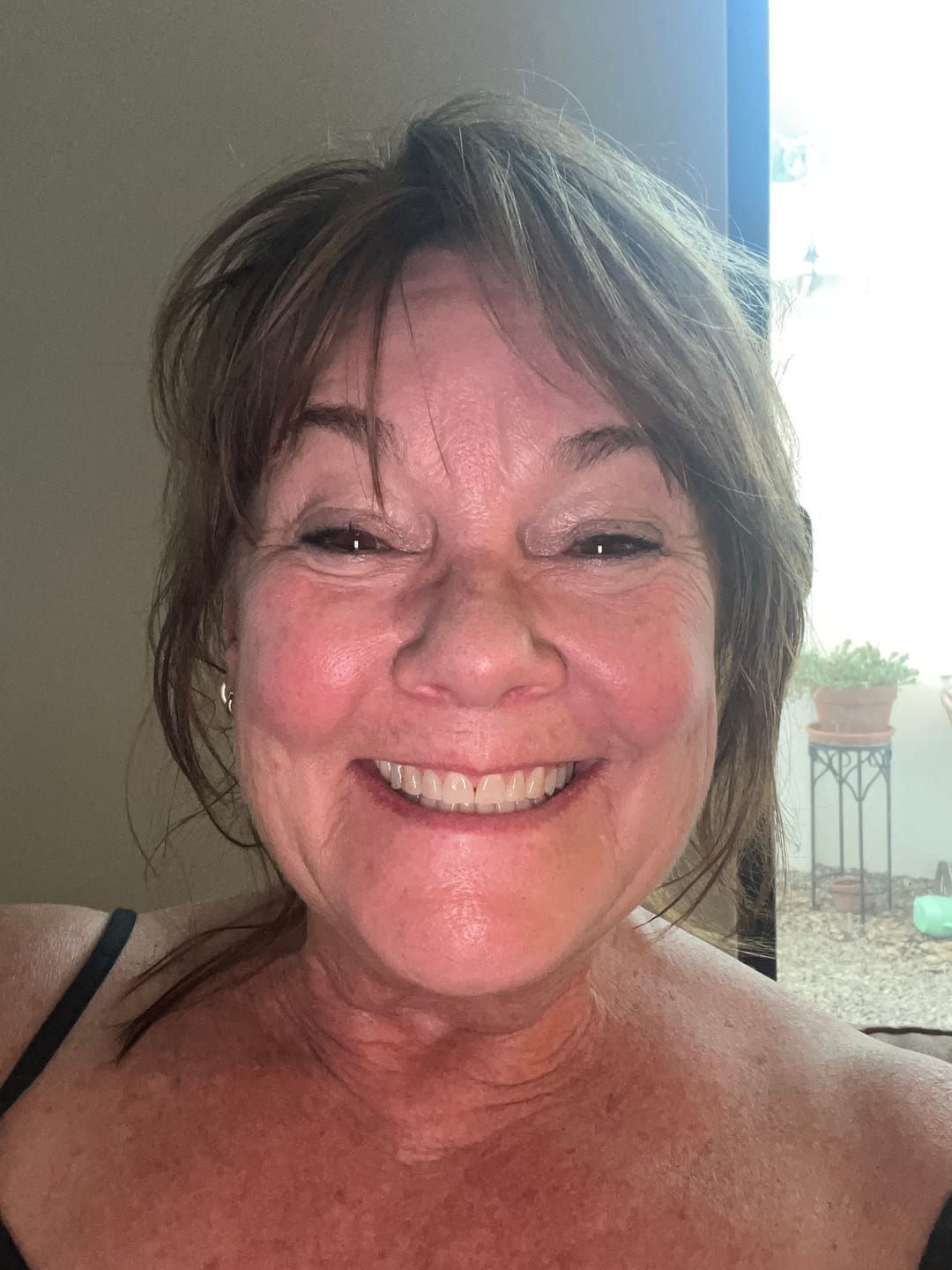 Customer photo review of F3 - DEEP HYDRATING AND PLUMPING SERUM