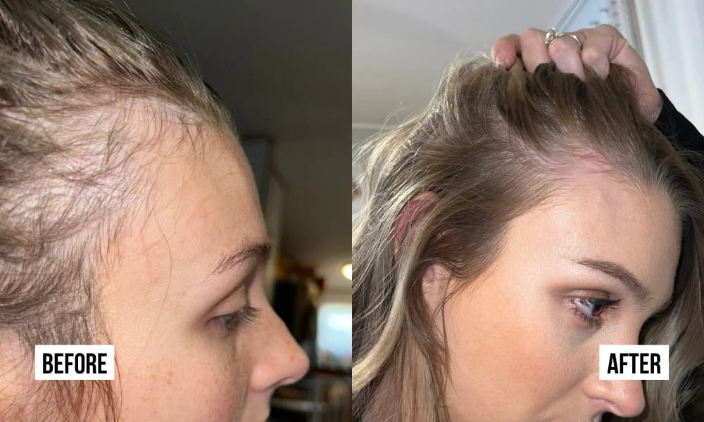 Customer photo review of Hair Growth Gummies