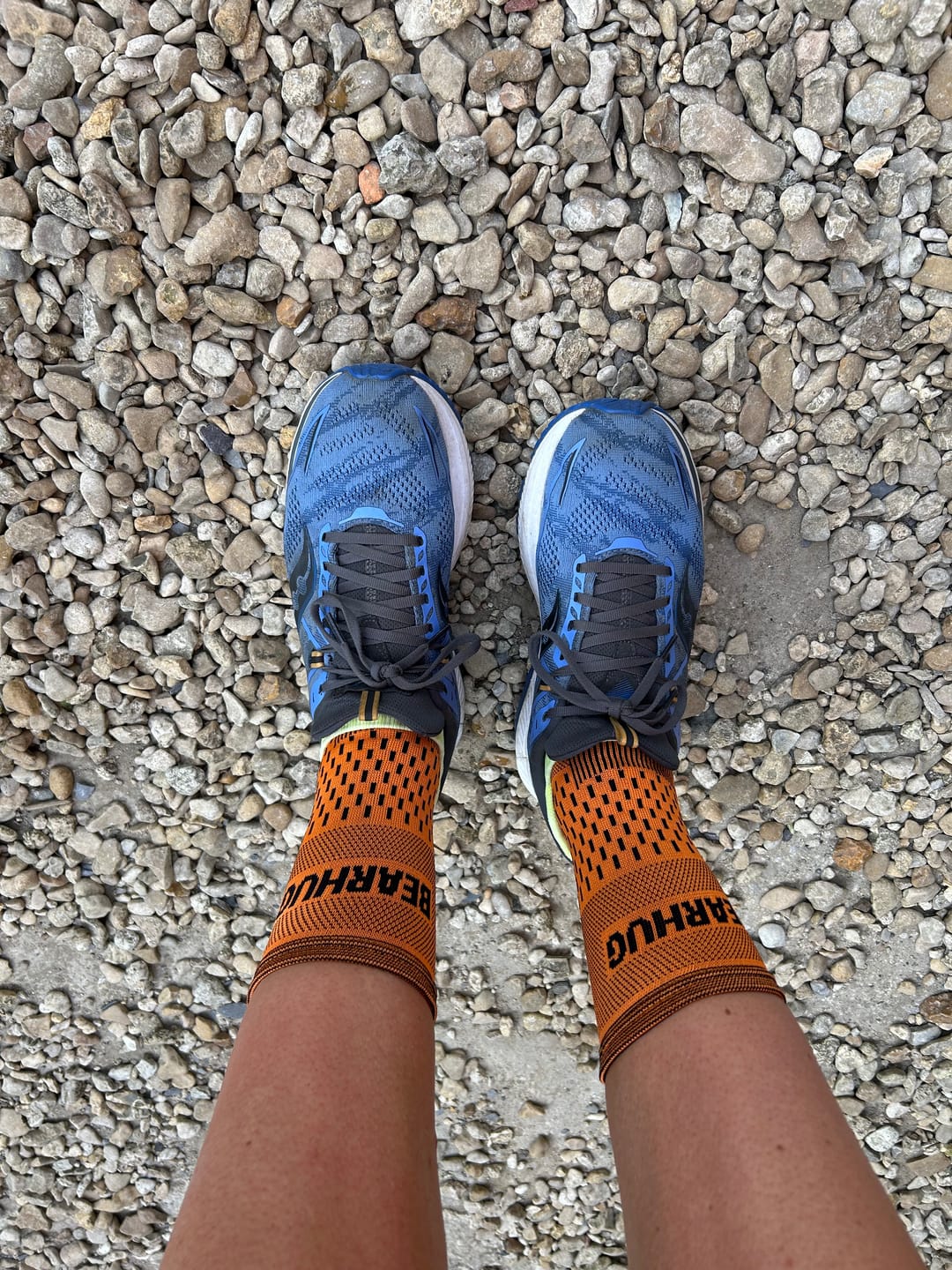 Customer photo review of Pair of Ankle Compression Support Sleeves For Achilles Tendon and Ankle Sprains