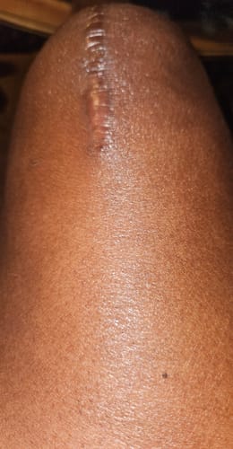 Customer photo review of Extra Strength Sweet Ginger Vapor Rub