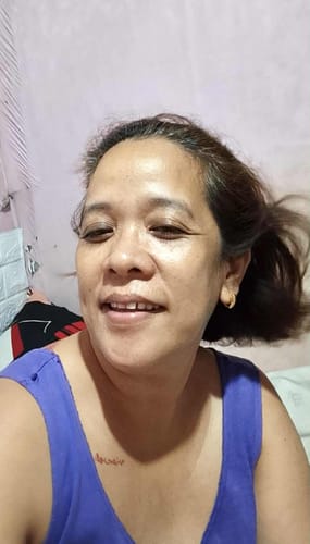 Customer photo review of Bad Skin™ Korean Collagen Bomb Hydrating Ampoule