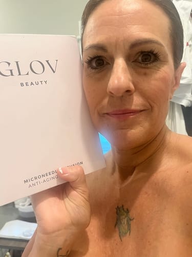Customer photo review of Glov Beaute Stretch Mark Kit