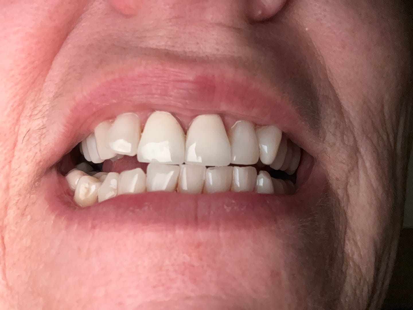 Gel toothpaste on toothbrush