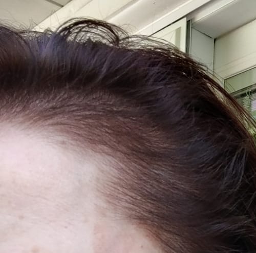 Customer photo review of Revive™ & Replenish™ - Hair Growth Shampoo and Conditioner