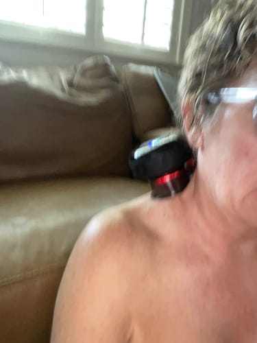 Customer photo review of Smart Cupping Massager