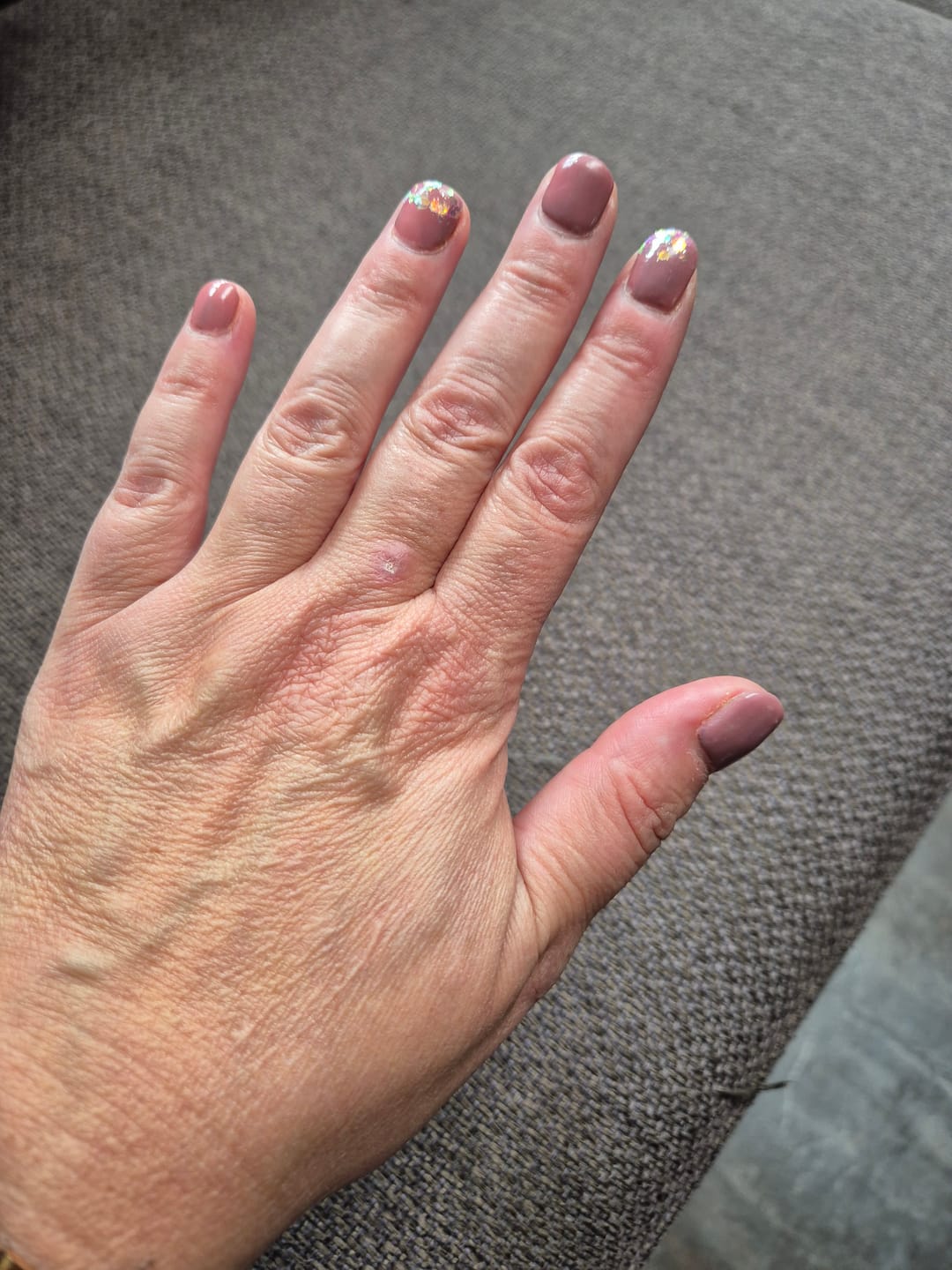 Customer photo review of Peel Off Base Coat